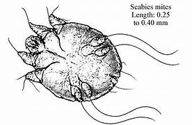 Mite causing scabies